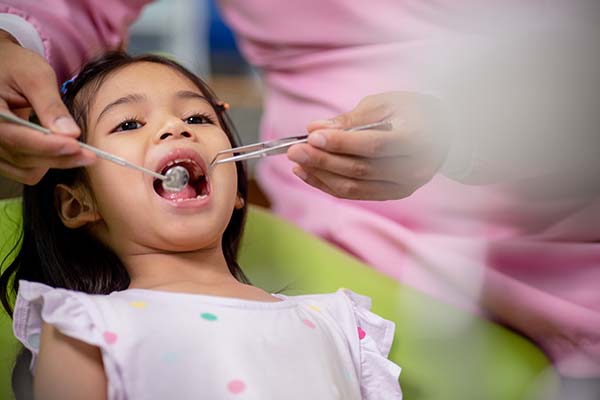 Preventing Childhood Tooth Decay: Tips From A Pediatric Dentist