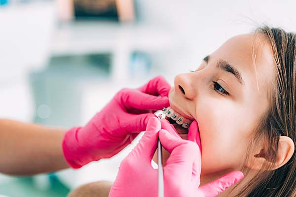 Common Pediatric Orthodontic Issues And How They Can Be Fixed